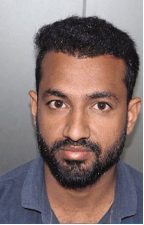 After — Hair transplant patient at DR HAIR® India, Jaipur, 3,500 grafts, FUE