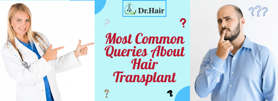 Read more about the article Most Common Queries About Hair Transplant