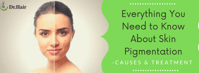 Read more about the article Everything You Need to Know About Skin Pigmentation- Causes & Treatment