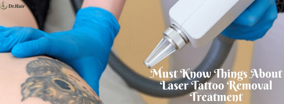 Must Know Things About Laser Tattoo Removal Treatment - Best Hair  Transplant In Jaipur, Hair Transplant specialist - Dr. Hair India