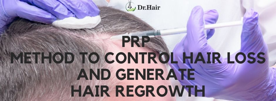 You are currently viewing PRP Method to Control Hair Loss and Generate Hair Regrowth
